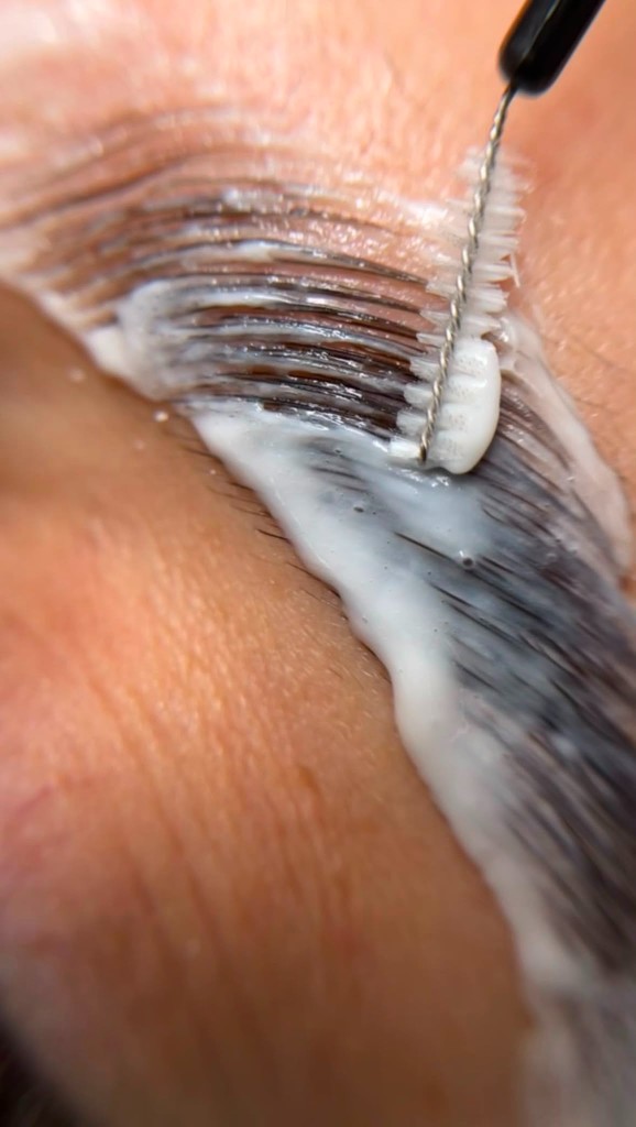 Brow Lift, restructuration des sourcils
